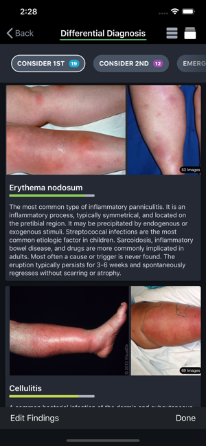 VisualDx Body Differential Diagnosis Screen